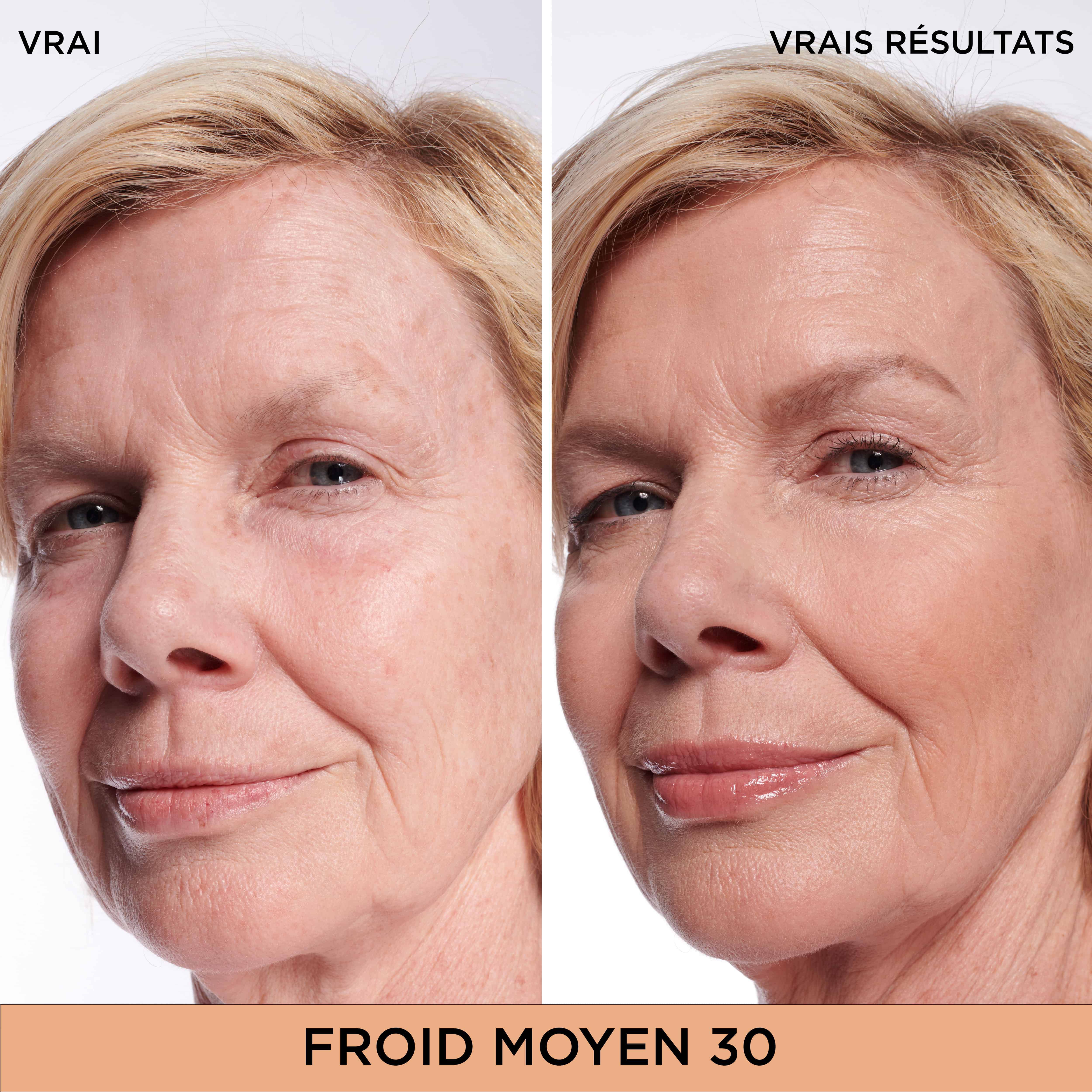 Bye Bye Dark Spots Cache-Cernes + Serum avec 2% de niacinamide