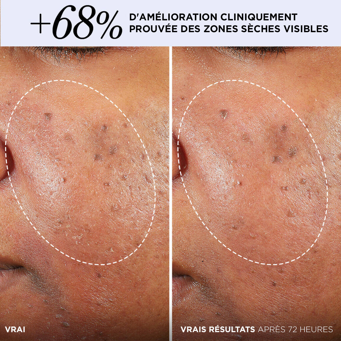 Confidence in a Cream® Barrier Boost Creme Booster de Barriere