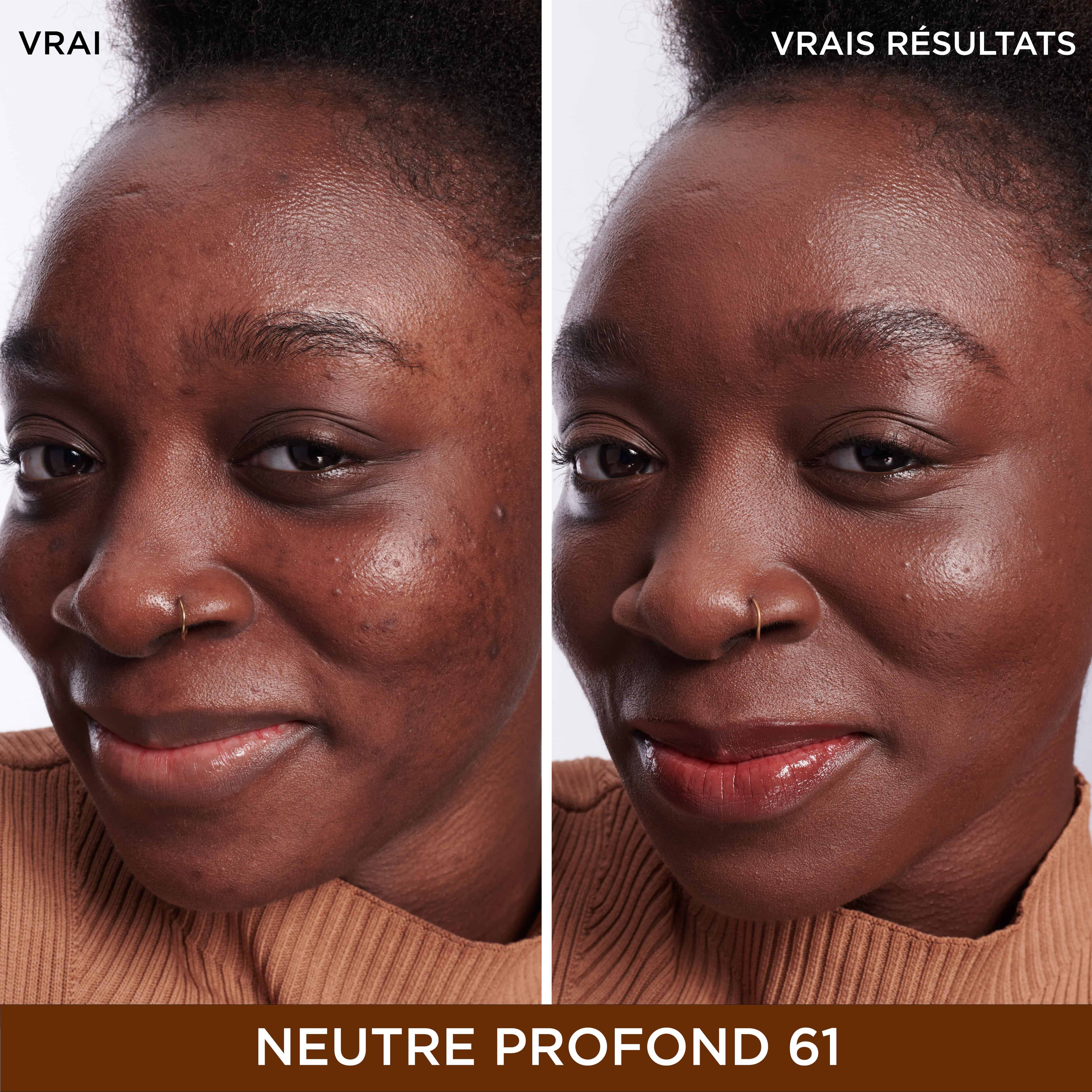 Bye Bye Dark Spots Cache-Cernes + Serum avec 2% de niacinamide