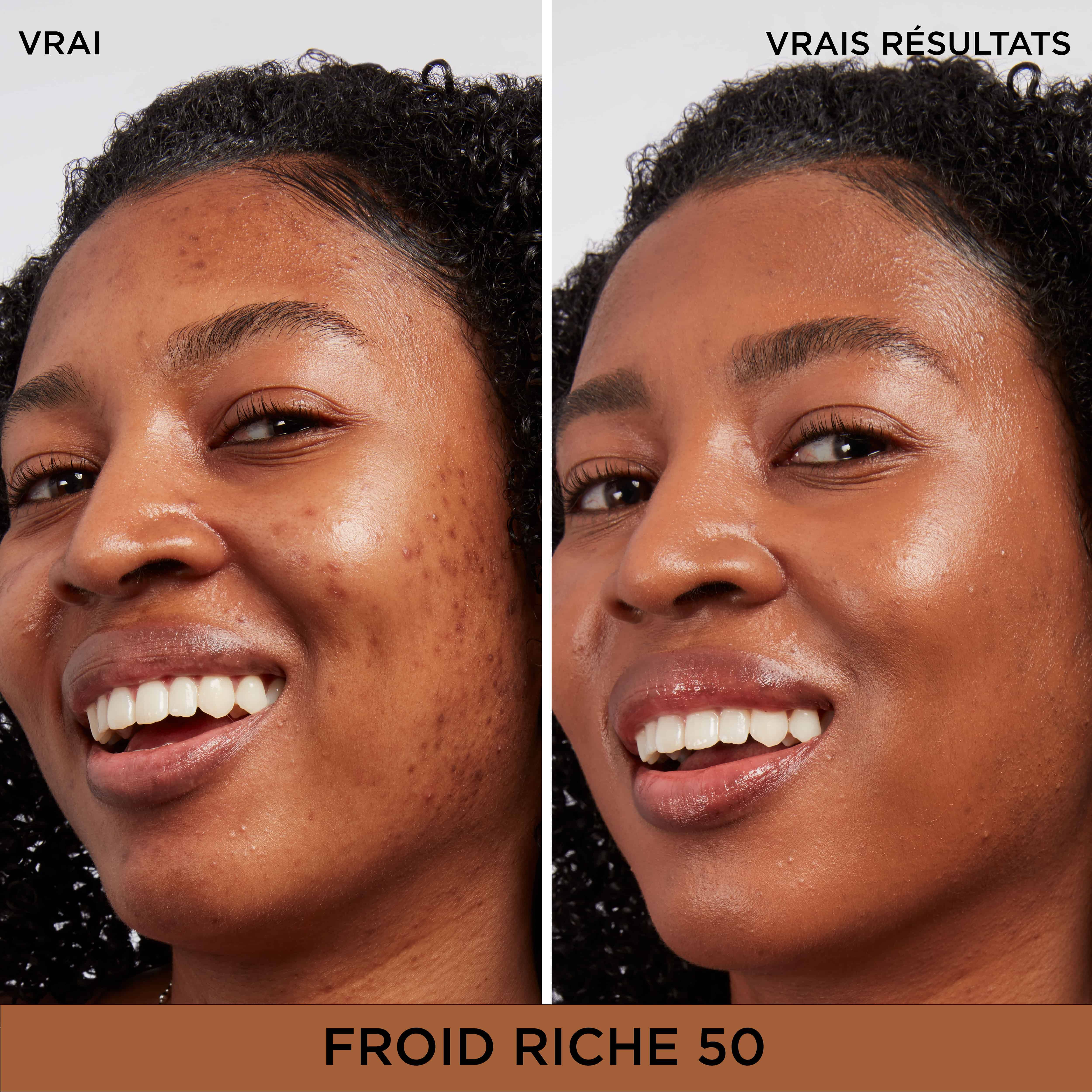 Bye Bye Dark Spots Cache-Cernes + Serum avec 2% de niacinamide