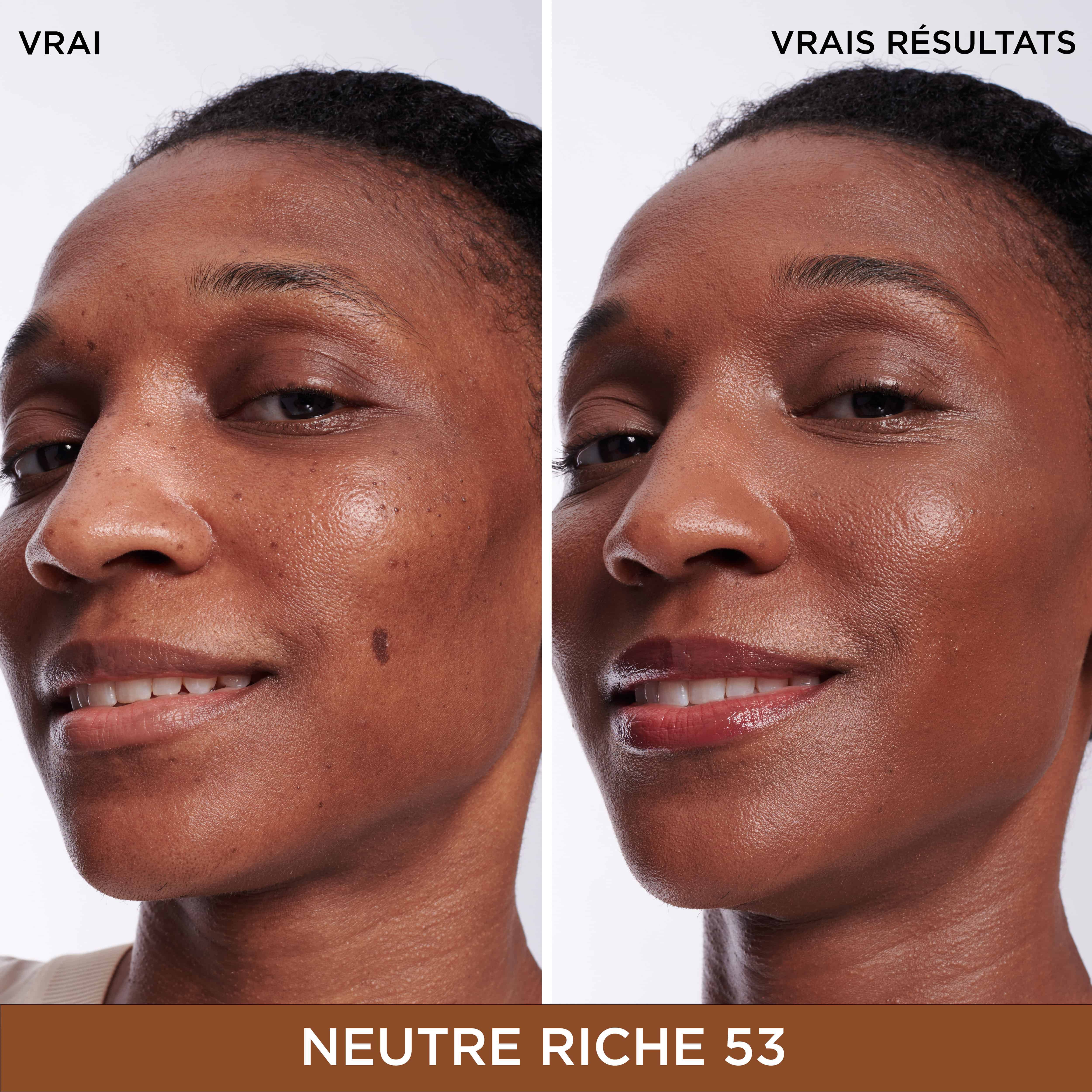 Bye Bye Dark Spots Cache-Cernes + Serum avec 2% de niacinamide
