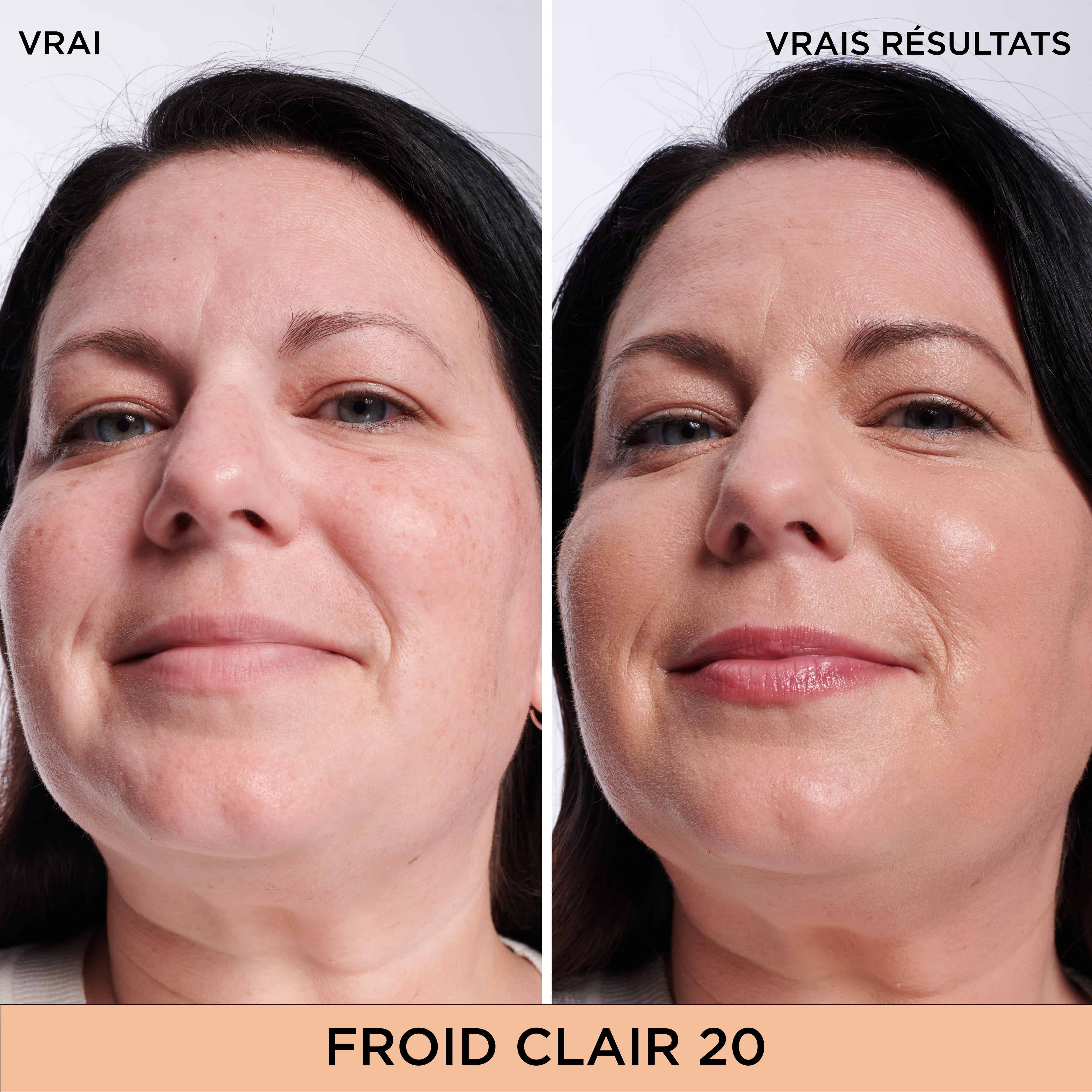 Bye Bye Dark Spots Cache-Cernes + Serum avec 2% de niacinamide