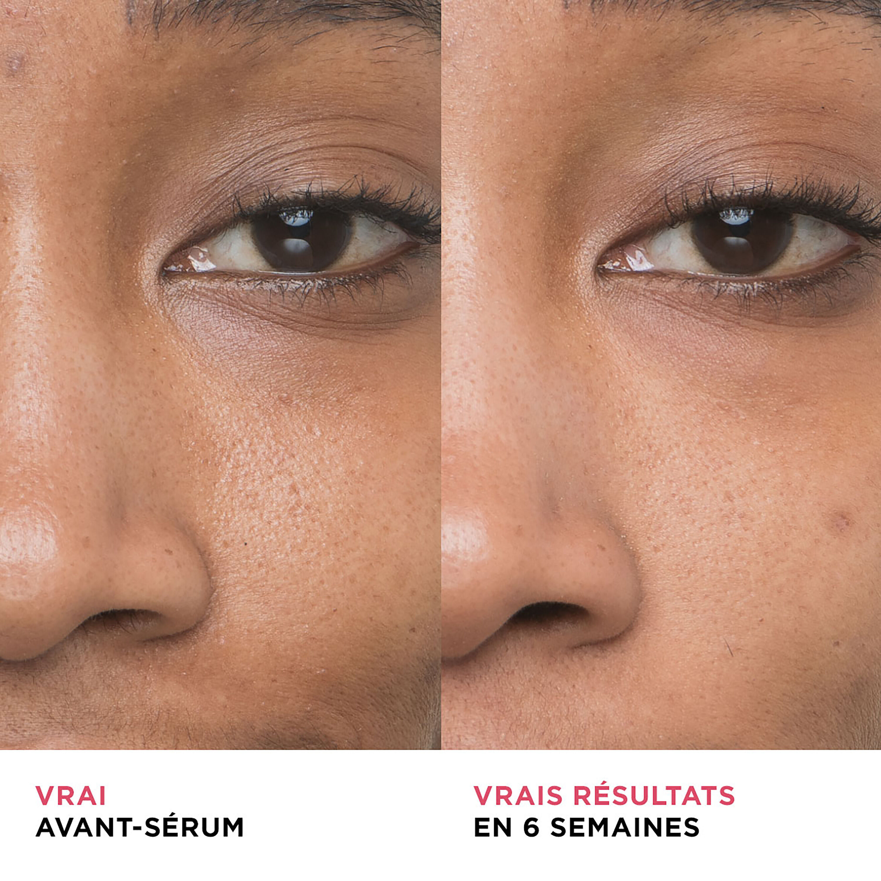 Serum Bye Bye Pores avec 10% d'acide glycolique