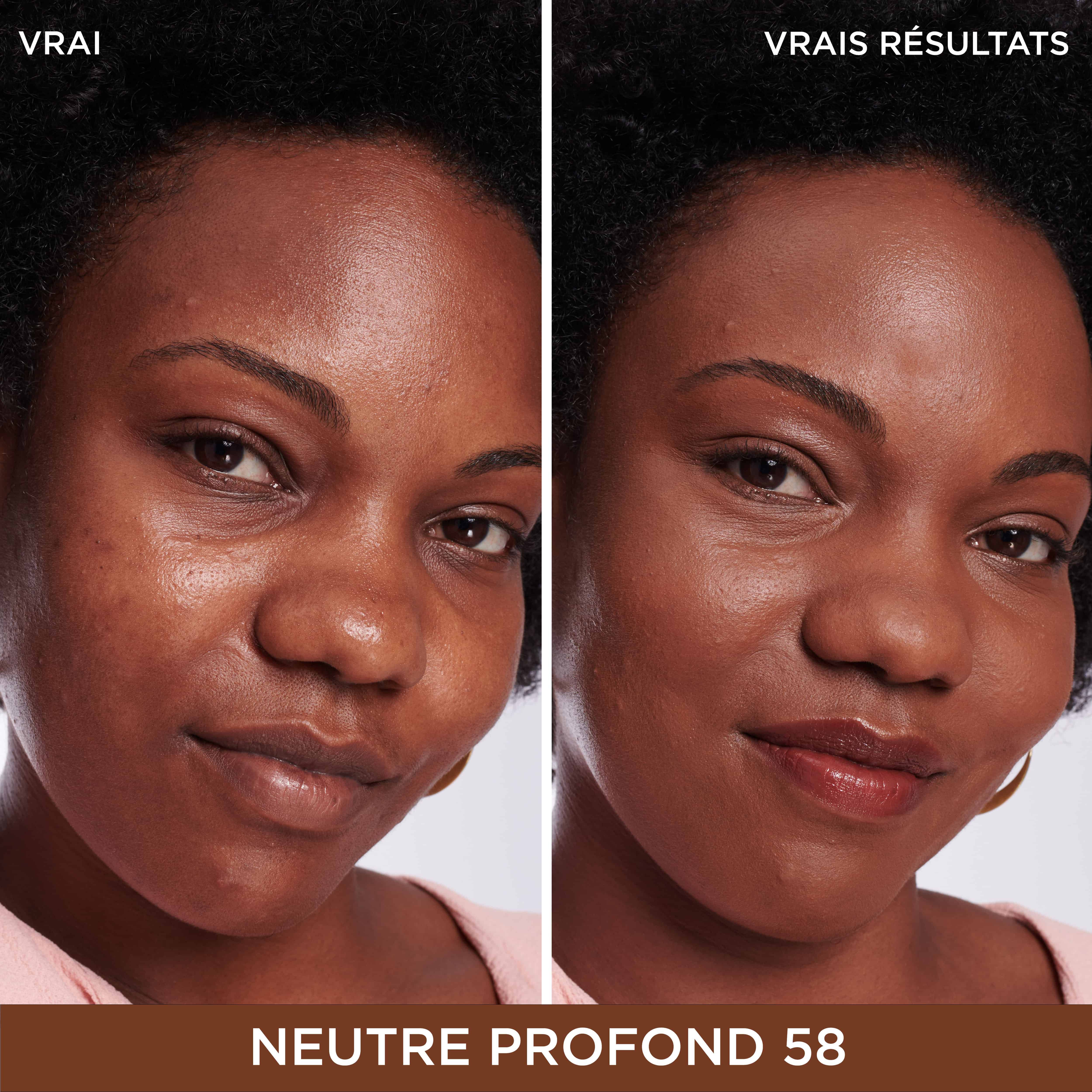 Bye Bye Dark Spots Cache-Cernes + Serum avec 2% de niacinamide