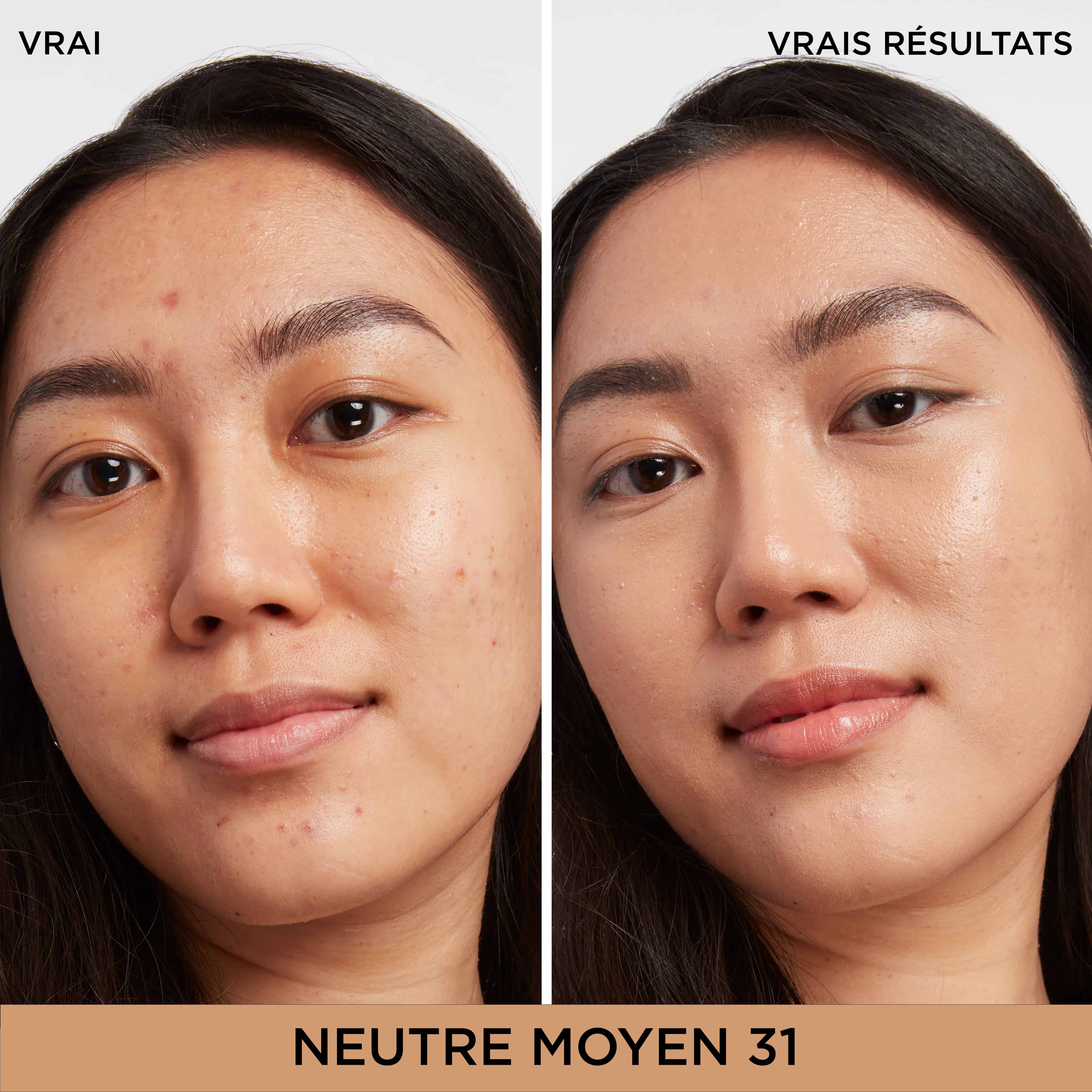 Bye Bye Dark Spots Cache-Cernes + Serum avec 2% de niacinamide