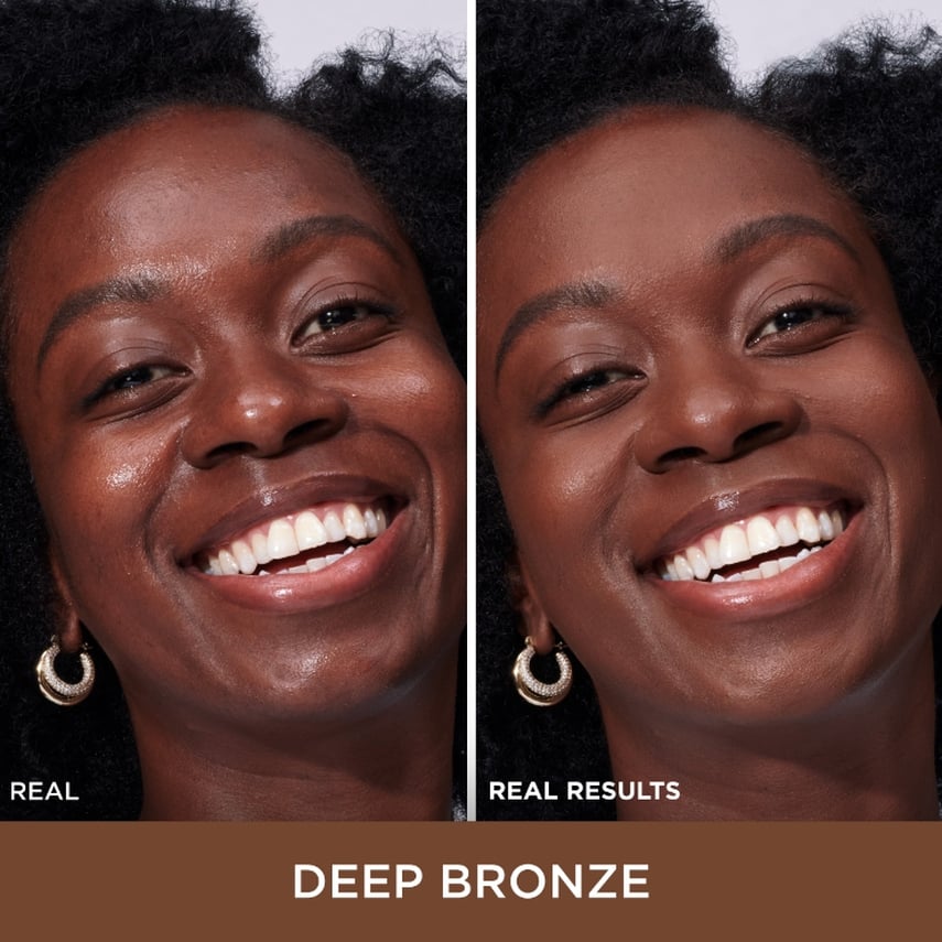 improved skin quality 