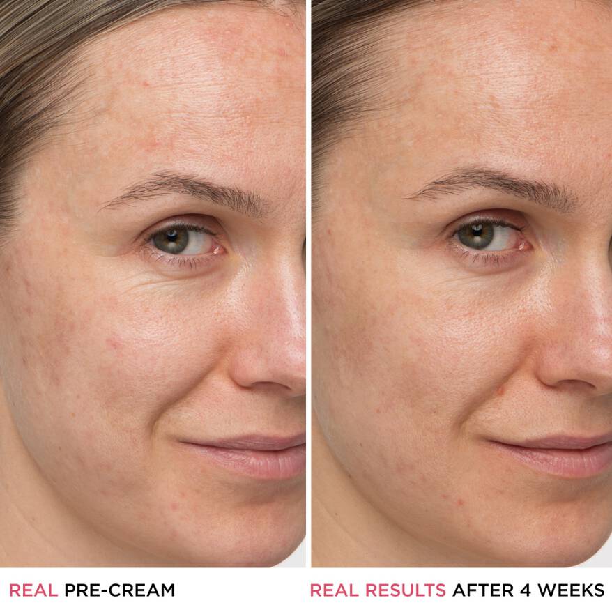 model image showing before and after of the product