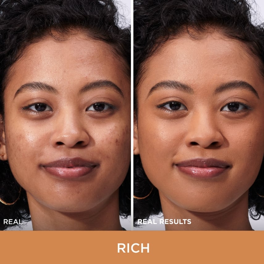 improved skin texture