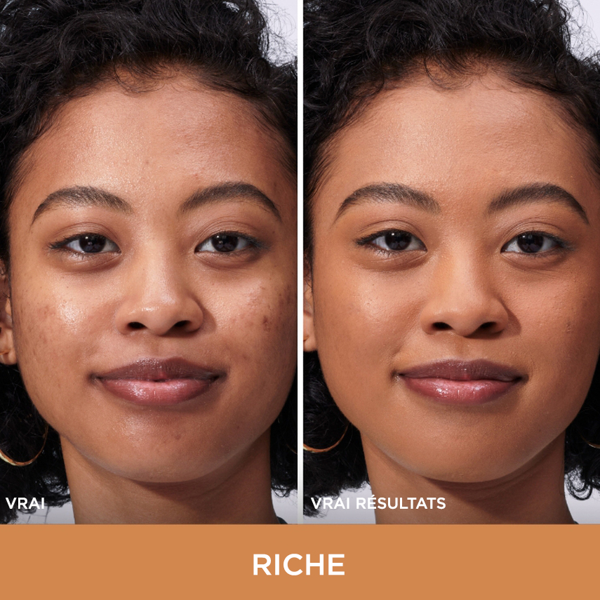 improved skin texture