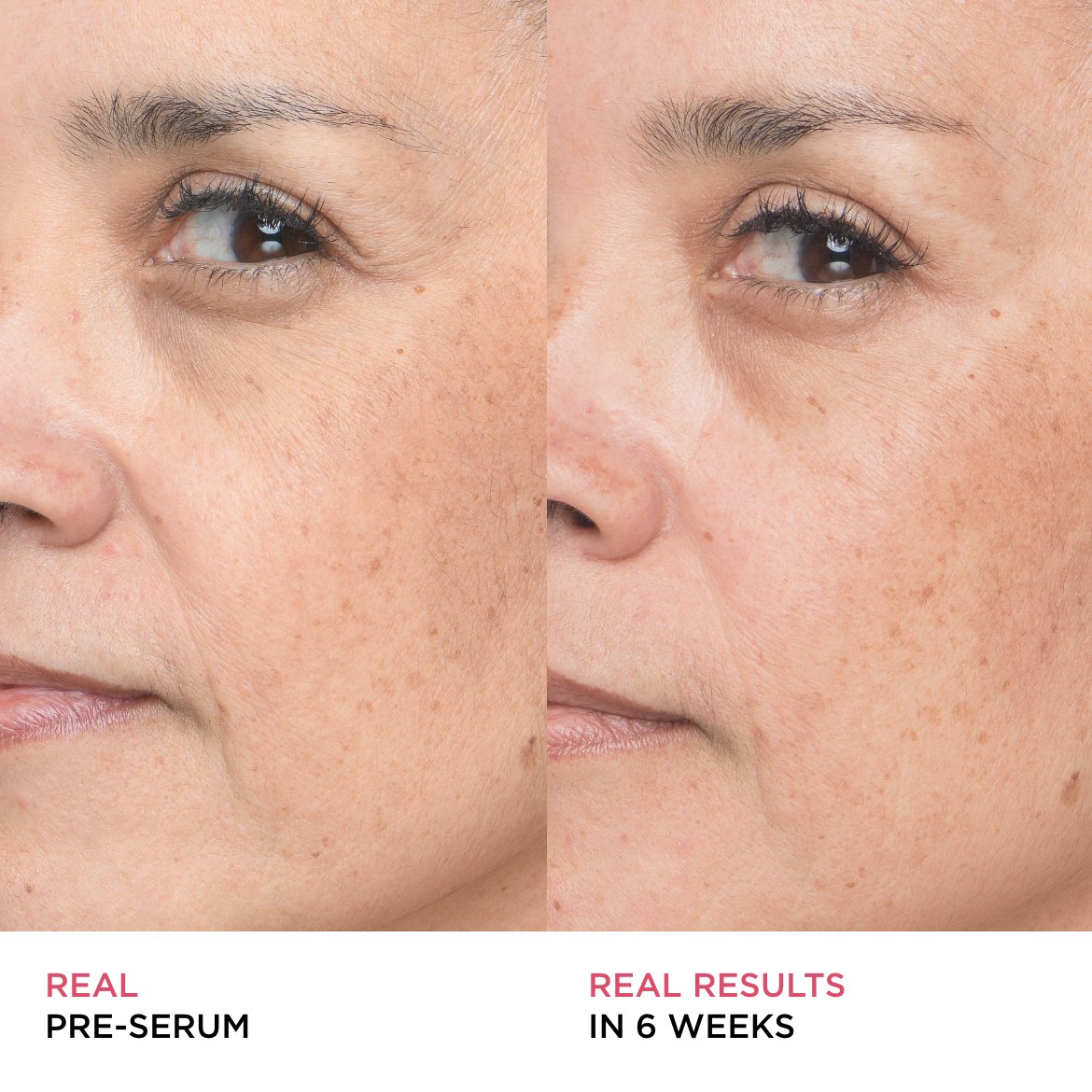before and after image of the model