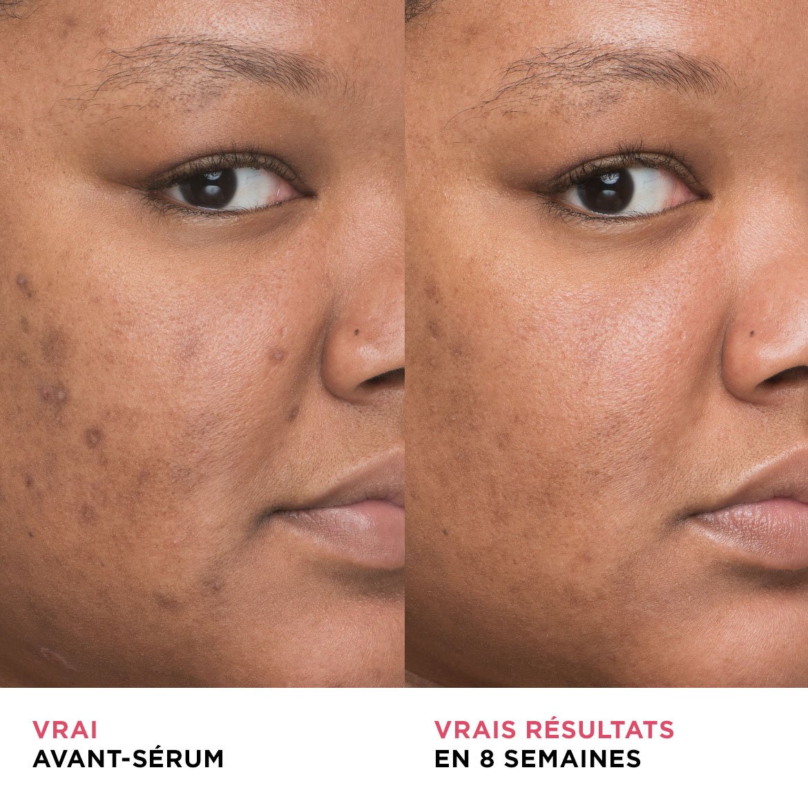 A model image of before and after